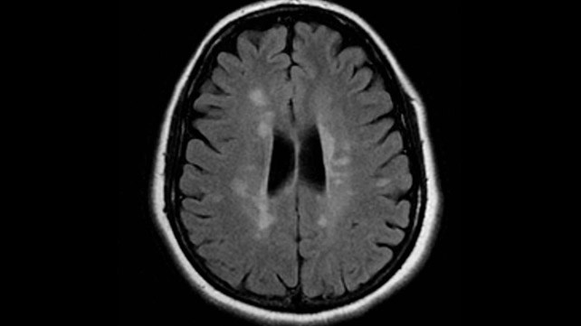 Νευρολογικό ιατρείο δρ Γεωργίου Στ. Βλάχου - ΣΚΠ - MRI